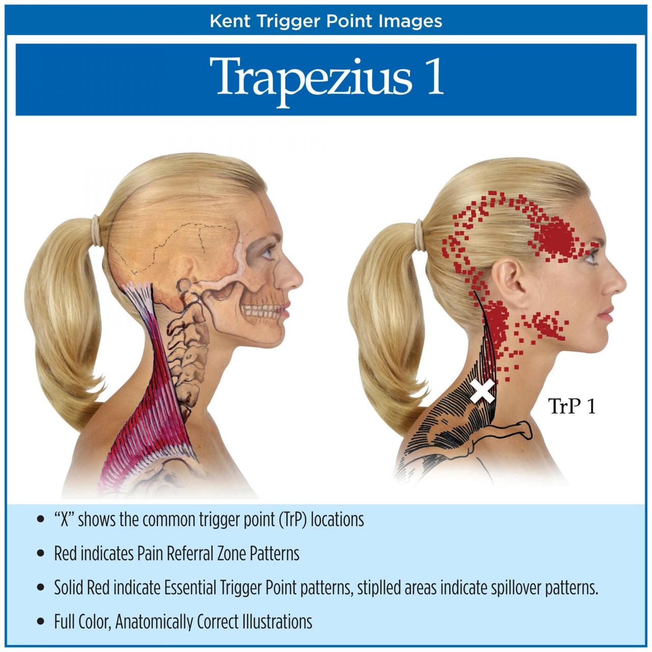 Muscles upper back tight neck pain exercises symptoms muscle tightness causes exercise treatment do loosen due stiffness relief necks